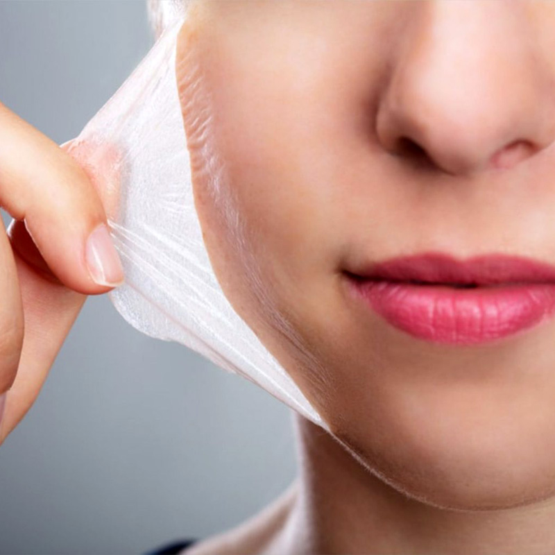 kimyasal peeling hizmetleri